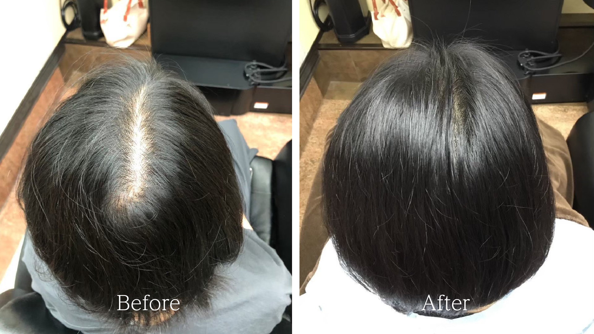 ふわつや診断ビフォーアフター01