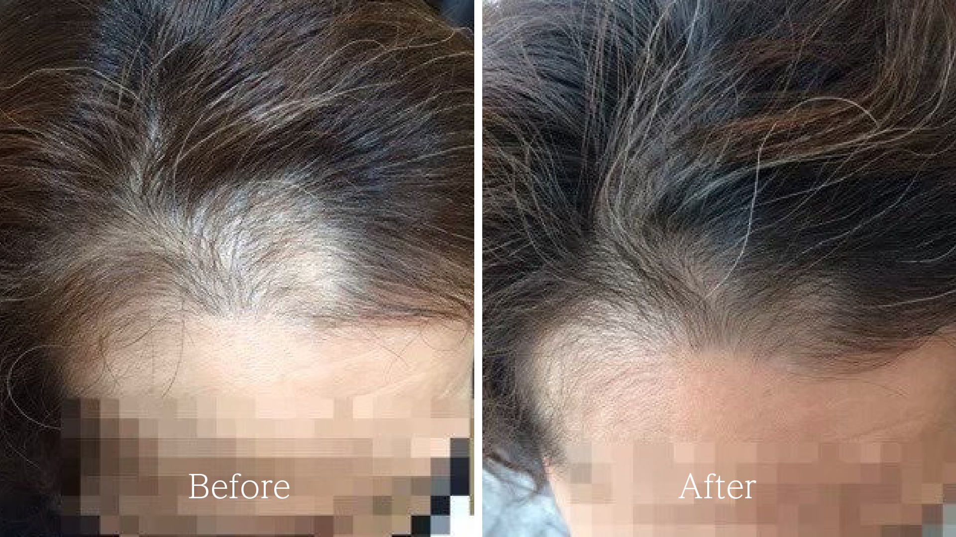 ふわつや診断ビフォーアフター03